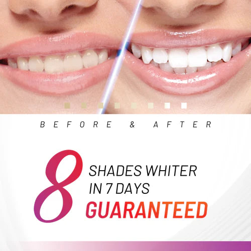 ACCELERATOR Teeth Whitening Kit