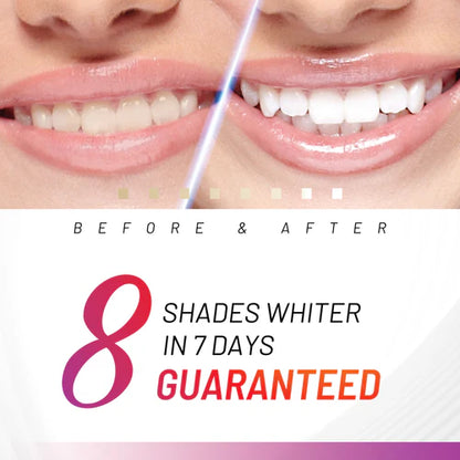 ACCELERATOR Teeth Whitening Kit